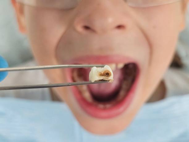 Best Emergency Dental Services for Seniors in Fyffe, AL